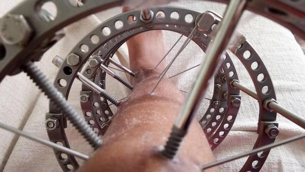 Jak ustawić przerzutki przednie w rowerze aby działały płynnie?